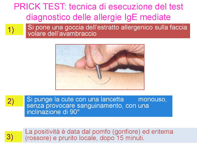 prick-test